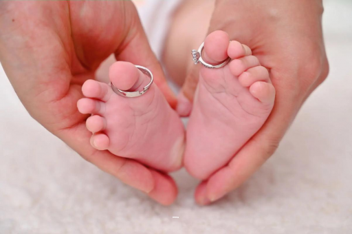 永州孕妇怎样预防妊娠纹